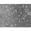 Human Seminal Vesicle Epithelial Cells (HSVEpiC) - Phase contrast, 100x.
