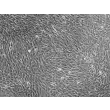 Human Skeletal Muscle Cells (HSkMC) - Phase contrast, 100x.
