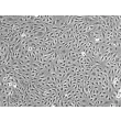 Human Splenic Endothelial Cells (HSEC) - Phase contrast, 100x.

