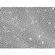Human Splenic Fibroblasts (HSF) - Phase contrast, 200x.
