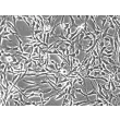 Human Synoviocytes (HS) - Phase contrast, 200x.
