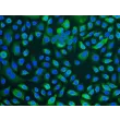 Human Tracheal Epithelial Cells (HTEpiC) - Immunostaining for CK-18, 100x.
