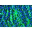 Human Tracheal Smooth Muscle Cells (HTSMC) - Immunostaining for α-sma, 400x.
