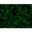 Mouse Astrocytes from CD1 (MA) - Immunostaining for GFAP, 100x. 
