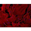 Mouse Brain Vascular Pericytes (MBVP) - Immunostaining for α-sma, 200x
