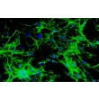 Mouse Cardiac Fibroblasts (MCF) - Immunostaining for Fibronectin, 200x.