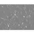 Mouse Dermal Fibroblasts (MDF)- Relief Contrast, 200x