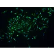 Mouse Hepatic Macrophages (MHMa)-Immunostaining for F4/80, 200x.
