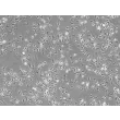 Mouse Hepatic Macrophages (MHMa)-Phase Contrast, 100x.
