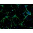 Mouse Neurons-forebrain (MN-fb)-Immunostaining for b-tubulin III, 200X