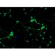 Mouse Neurons-hippocampal (MN-h) - Immunostaining for β-Tubulin III, 200x.
