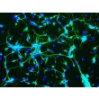 Mouse Neurons-striatal (MN-s) - Immunostaining for β-Tubulin III, 200x.
