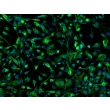 Mouse Pulmonary Alveolar Epithelial Cells (MPAEpiC) - Immunostaining for CK-18, 200x
