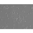 Mouse Pulmonary Alveolar Macrophages (MPAMa) - Relief contrast, 200x
