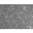 Mouse Pulmonary Alveolar Macrophages (MPAMa) - Phase contrast, 100x
