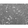 Mouse Pulmonary Fibroblasts from CD-1 (MPF) - phase contrast, 100x