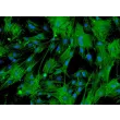 Mouse Renal Mesangial Cells (MRMC) - Immunostaining for α-SMA, 200x.
