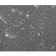 Mouse Renal Mesangial Cells (MRMC) - Phase contrast, 100x.
