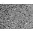 Mouse Renal Proximal Tubular Epithelial Cells (MRPTEpiC) - Phase contrast, 100x.
