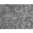 Mouse Splenic Macrophages (MSMa) – Phase Contrast, 100x
