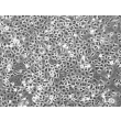 Porcine Corneal Epithelial Cells (PCEpiC) - Phase contrast, 100x.
