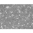 Rabbit Hepatic Stellate Cells (RabHSteC) – Phase Contrast, 100X.
