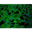 Rabbit Hepatic Stellate Cells (RabHSteC) – Immunostaining for alpha-smooth muscle actin, 200x.
