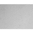 Rat Astrocytes-adult -Relief Contrast, 200x
