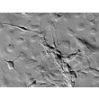 Rat Atsrocytes-hippocampal (RA-h) - Relief contrast