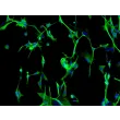 Rat Astrocytes-Midbrain (RA-mb)- Immunostaining for GFAP, 200x
