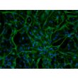 Rat Astrocytes-spinal cord (RA-sc)-Immunostaining for GFAP, 200X