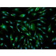 Rat Hepatic Macrophage (RHMa) - Immunostaining for F4-80, 200x.
