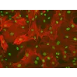 Rat Hepatic Stellate Cells (RHSteC) - Immunostaining for α-SMA, 200x.

