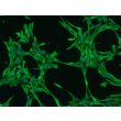 Rat Lens Epithelial Cells (RLEpiC) - Immunostaining for CK18, 200x