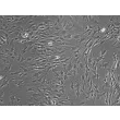 Rat Lymphatic Fibroblasts (RLF) - Phase Contrast, 100x