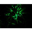 Rat Neurons-hindbrain (RN-hb)-Immunostaining for β-tubulin III, 200X