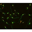 Rat Neurons-hippocampal (RN-h) - Immunostaining for β-Tubulin III, 400x.
