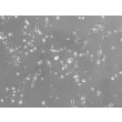 Rat Neurons-hippocampal (RN-h) - Phase contrast, 200x.
