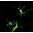 Rat Neurons-striatal (RN-s) - Immunostaining for β-Tubulin III (green) and S100-β, 400x.

