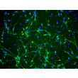 Rat Neurons-striatal (RN-s) - Immunostaining for β-Tubulin III, 200x.
