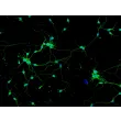 Rat Neurons-substantia nigra (RN-sn) - Immunostaining for β-Tubulin III, 200x.
