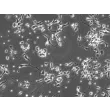 Rat Neurons-substantia nigra (RN-sn) - Phase contrast, 200x.
