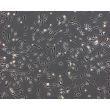 Rat Perineurial Fibroblasts (RPNF)- Phase Contrast, 100X.