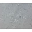 Rat Perineurial Fibroblasts (RPNF)- Relief Contrast, 200X.
