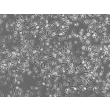 Rat Pulmonary Alveolar Macrophages (RPAMa) - Phase contrast, 100x
