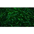 Rat Schwann Cells (RSC) - Immunostaining for S100-β, 100x.
