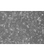 人类支气管成纤维细胞 (HBF) - 相差显微镜，200倍
