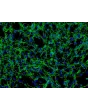 人类肺动脉外膜成纤维细胞（HPAAF）- 免疫染色纤维连接蛋白，200倍。