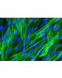 人类肺动脉平滑肌细胞 [HPASMC] - α-SMA 的免疫染色，400倍