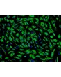 人类肺毛细血管内皮细胞 (HPMEC) - vWF 免疫染色, 200倍